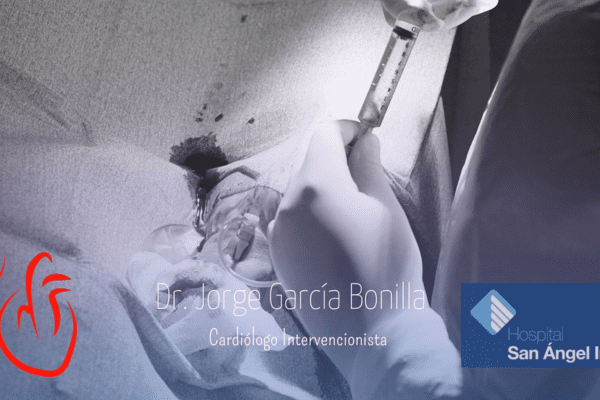 Cardiología intervencionista en CDMX